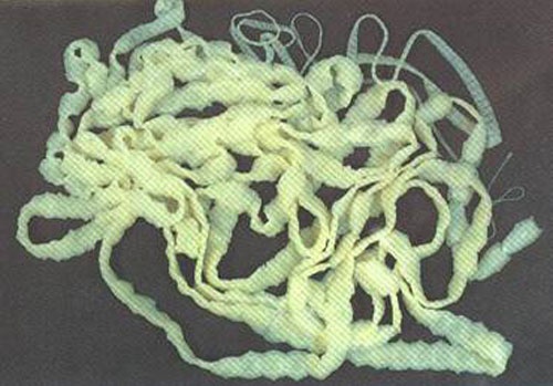 Nhiem san xo mit tu mon an tai song hinh anh