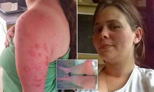 Co gai ma ca rong hinh anh