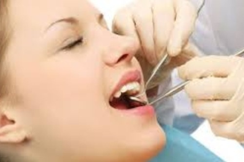 Can luu y gi sau khi nho rang khon? hinh anh