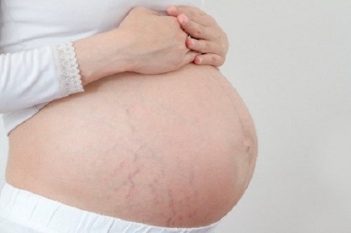 Da thay doi the nao khi mang thai? hinh anh