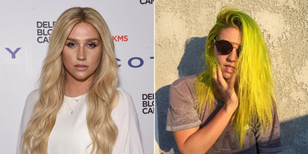 Kesha