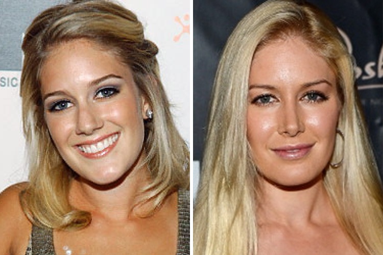 Heidi Montag ($30,000)