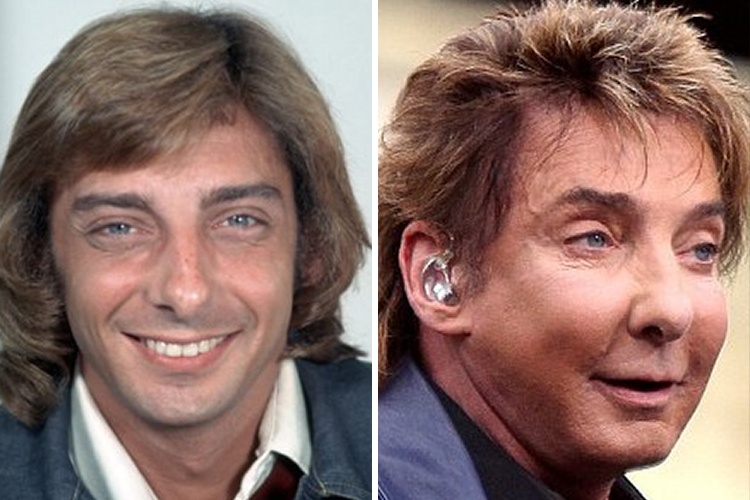 Barry Manilow ($70,000)