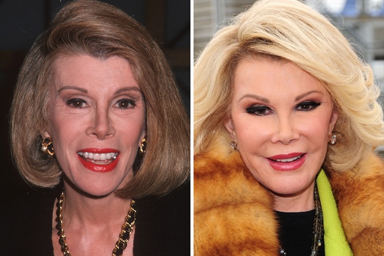 Joan Rivers ($99,000)