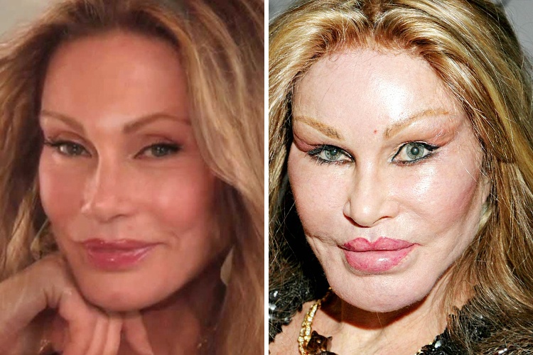 Jocelyn Wildenstein ($2 Million)