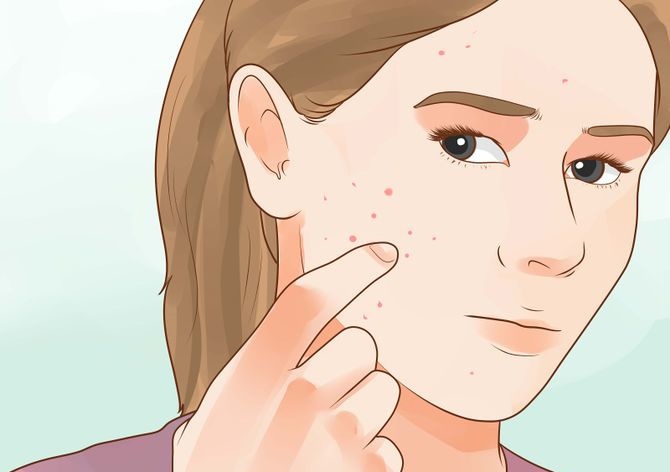 Nước cơm trị mụn: Với những đốm mụn nhỏ, bạn có thể thoa nước cơm lên và để khô, sau đó rửa sạch lại. Tác dụng của nước cơm sẽ giúp mụn giảm sưng đỏ, nhanh se và lành hơn.