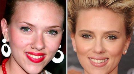 10 sao Hollywood khon kho vi mat mun hinh anh