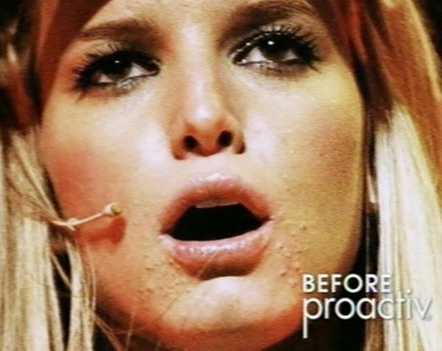 bi quyet sao tri mun trung ca anh 3