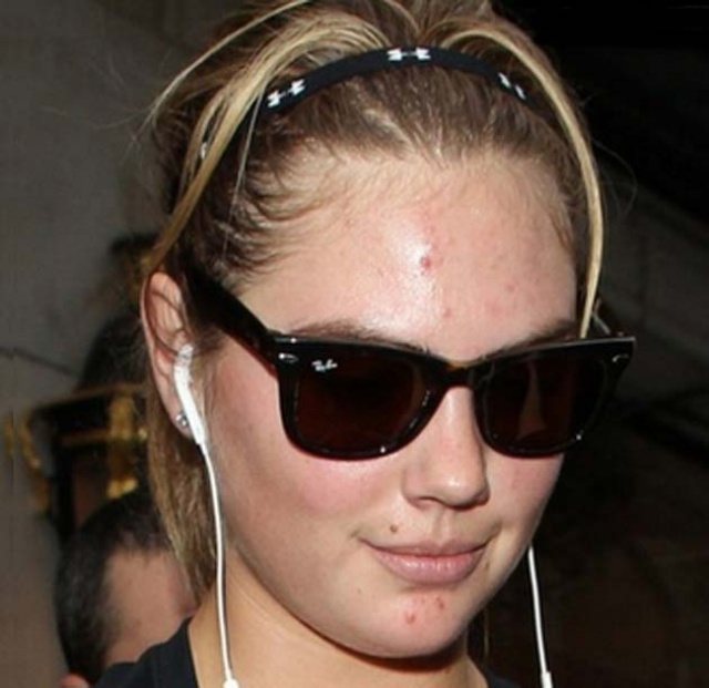 bi quyet sao tri mun trung ca anh 5