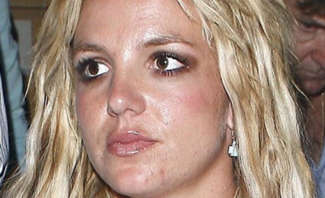 bi quyet sao tri mun trung ca anh 6