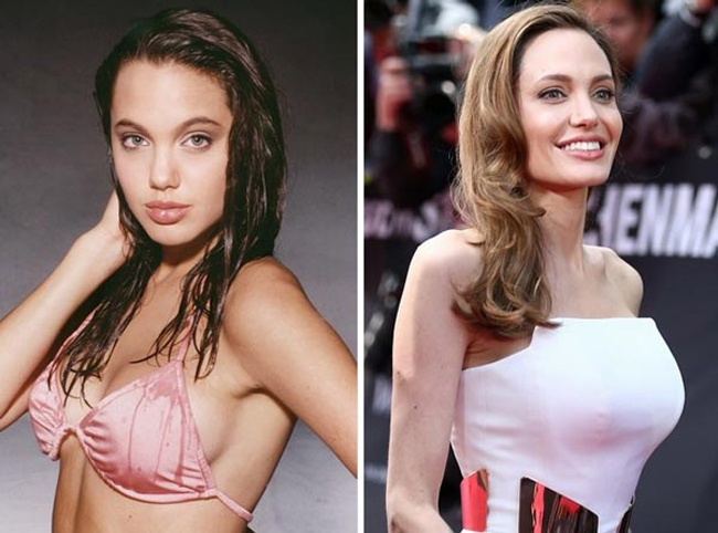 Sao nâng ngực tốn kém ảnh 10 Sao nang nguc ton kem anh 10