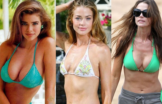 Sao nâng ngực tốn kém ảnh 6 Sao nang nguc ton kem anh 6