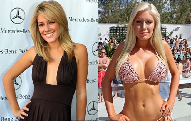 Sao nâng ngực tốn kém ảnh 7 Sao nang nguc ton kem anh 7