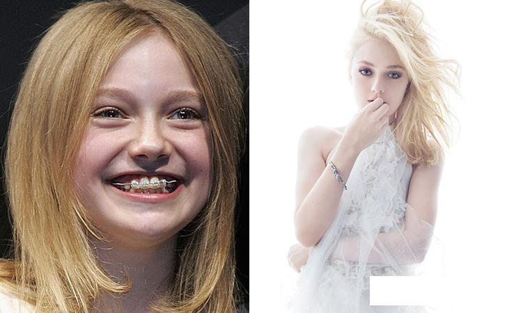 sao thoi tre xau xi anh 14