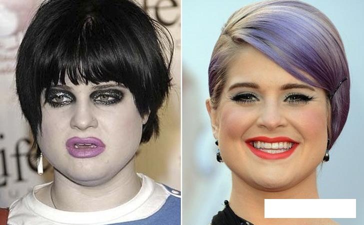 sao thoi tre xau xi anh 17