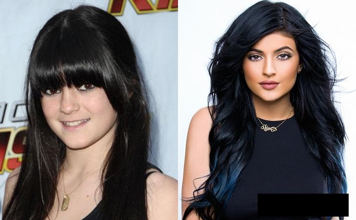 sao thoi tre xau xi anh 8