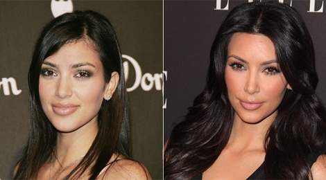 Qua trinh bien doi nhan sac tu co vit xau xi cua Kim hinh anh