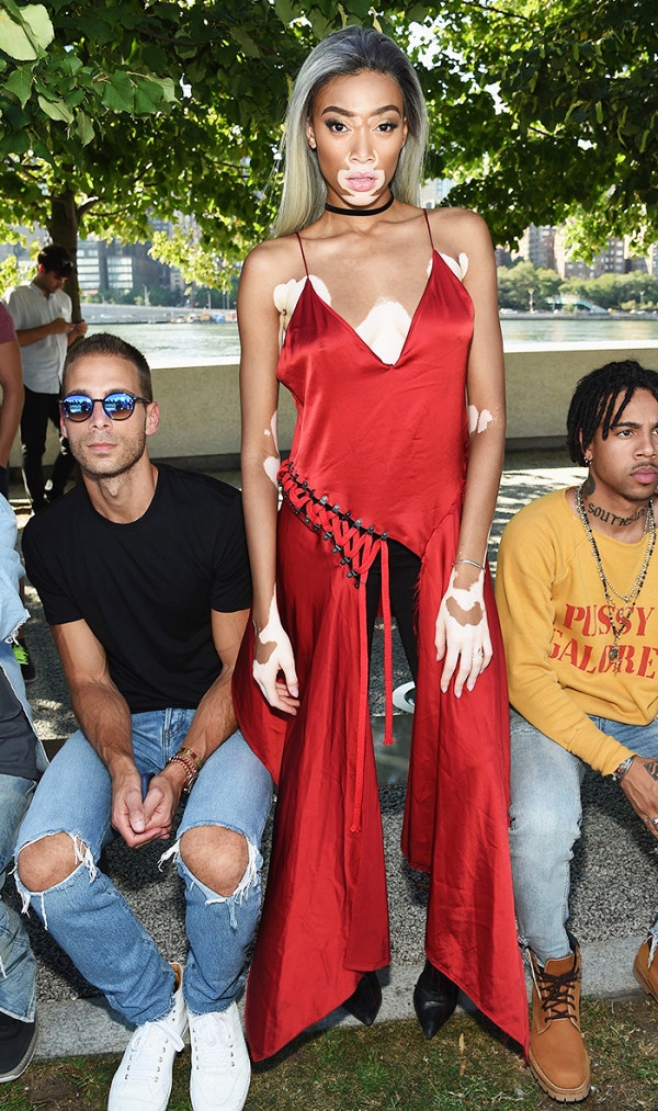 Winnie Harlow ảnh 8 Winnie Harlow anh 8