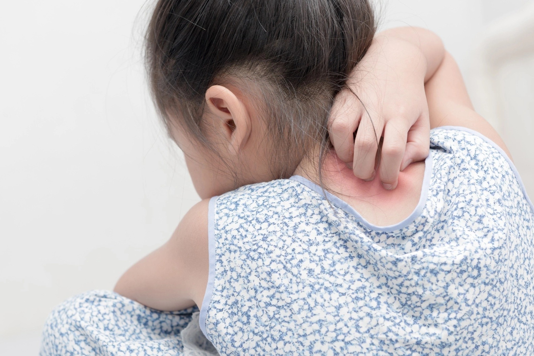 Benh pho bien o tre em nhung thuong nham sang benh khac hinh anh