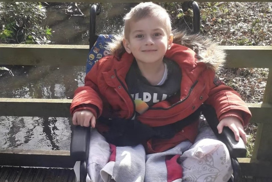 Cau be 6 tuoi o Anh phai cat cut chan vi nhiem lien cau khuan nhom A hinh anh