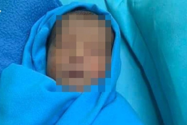 Be trai 2 tuan tuoi bi bo roi voi nhieu not con trung can hinh anh