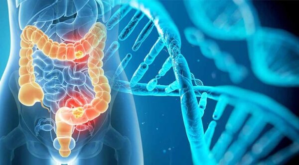 Nhung benh ung thu co nguy co di truyen cao hinh anh