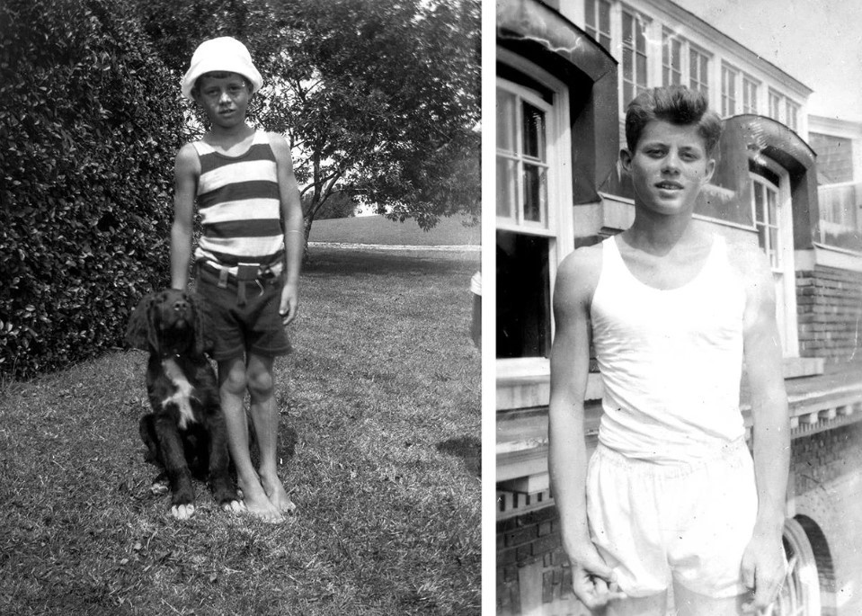 John F. Kennedy hoi nho va nhung van de suc khoe duoc giau kin hinh anh