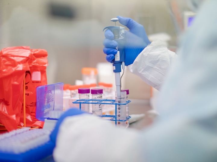 mot nua so xet nghiem Covid duong tinh voi Covid o Mexico anh 1