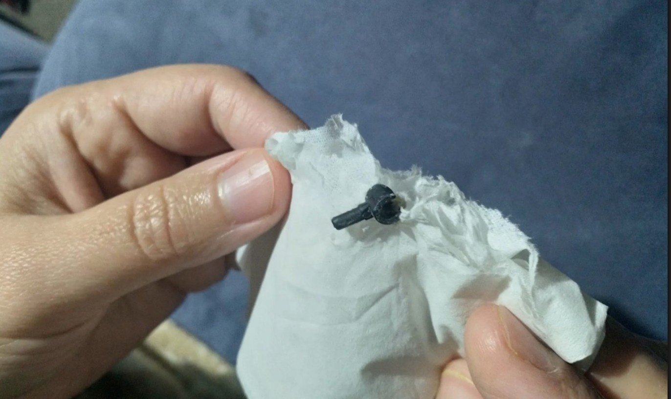 Mieng Lego roi tu mui be 7 tuoi sau khi mac ket 2 nam hinh anh