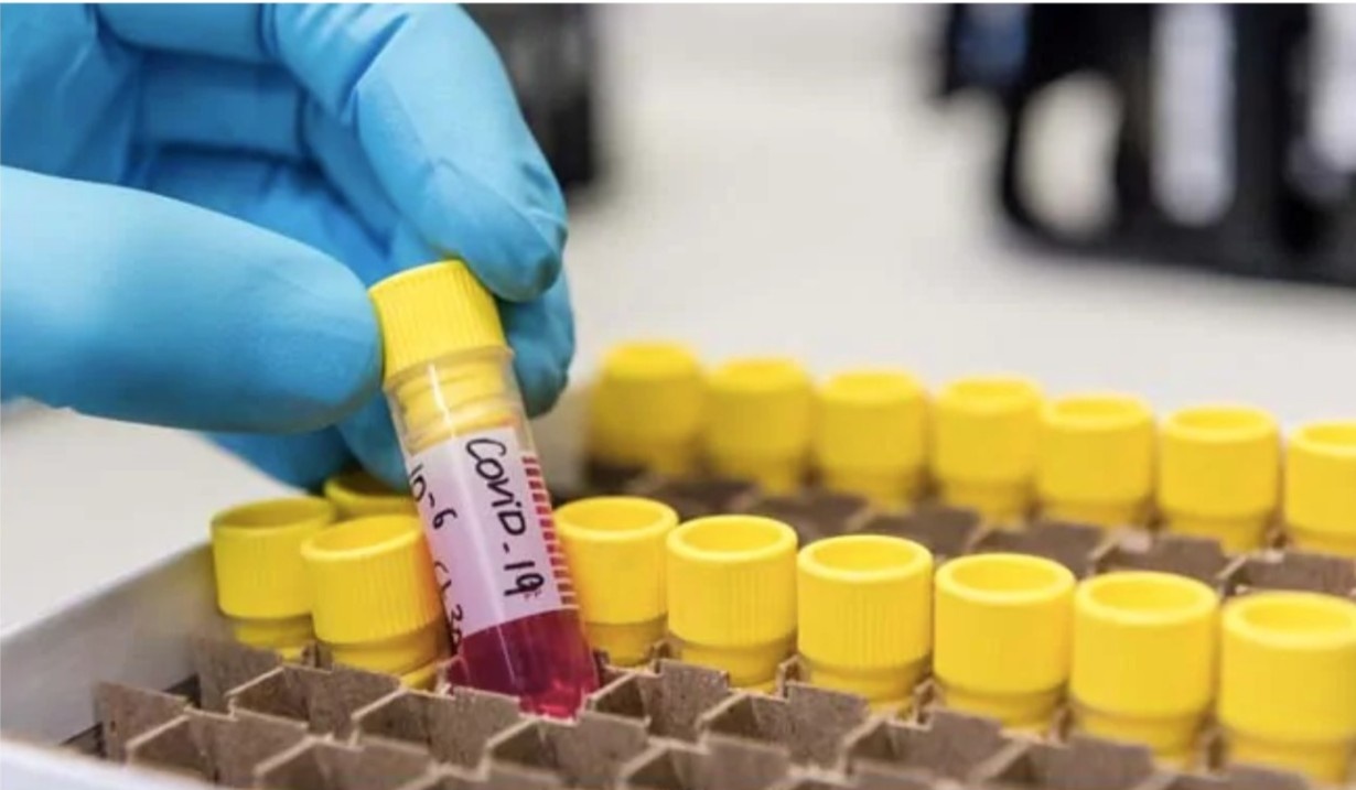 Phat hien di chung la cua Covid-19 hinh anh