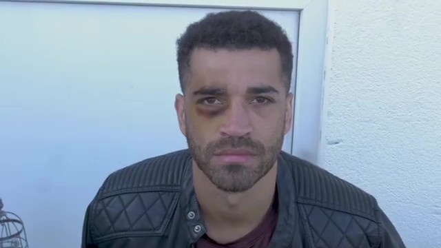 Nha vo dich WBO lo tay tu dam vao mat trong khi tap luyen hinh anh