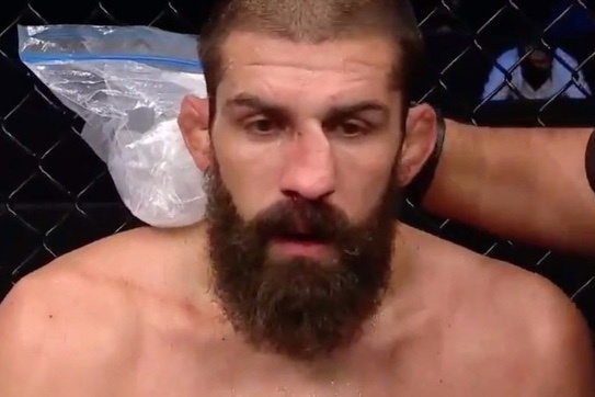 Vo si UFC bi dam lech mui hinh anh