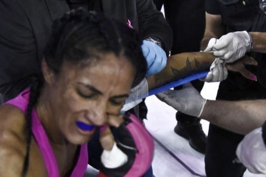 Nu vo si MMA bi gay tay sau don khoa cua doi thu hinh anh