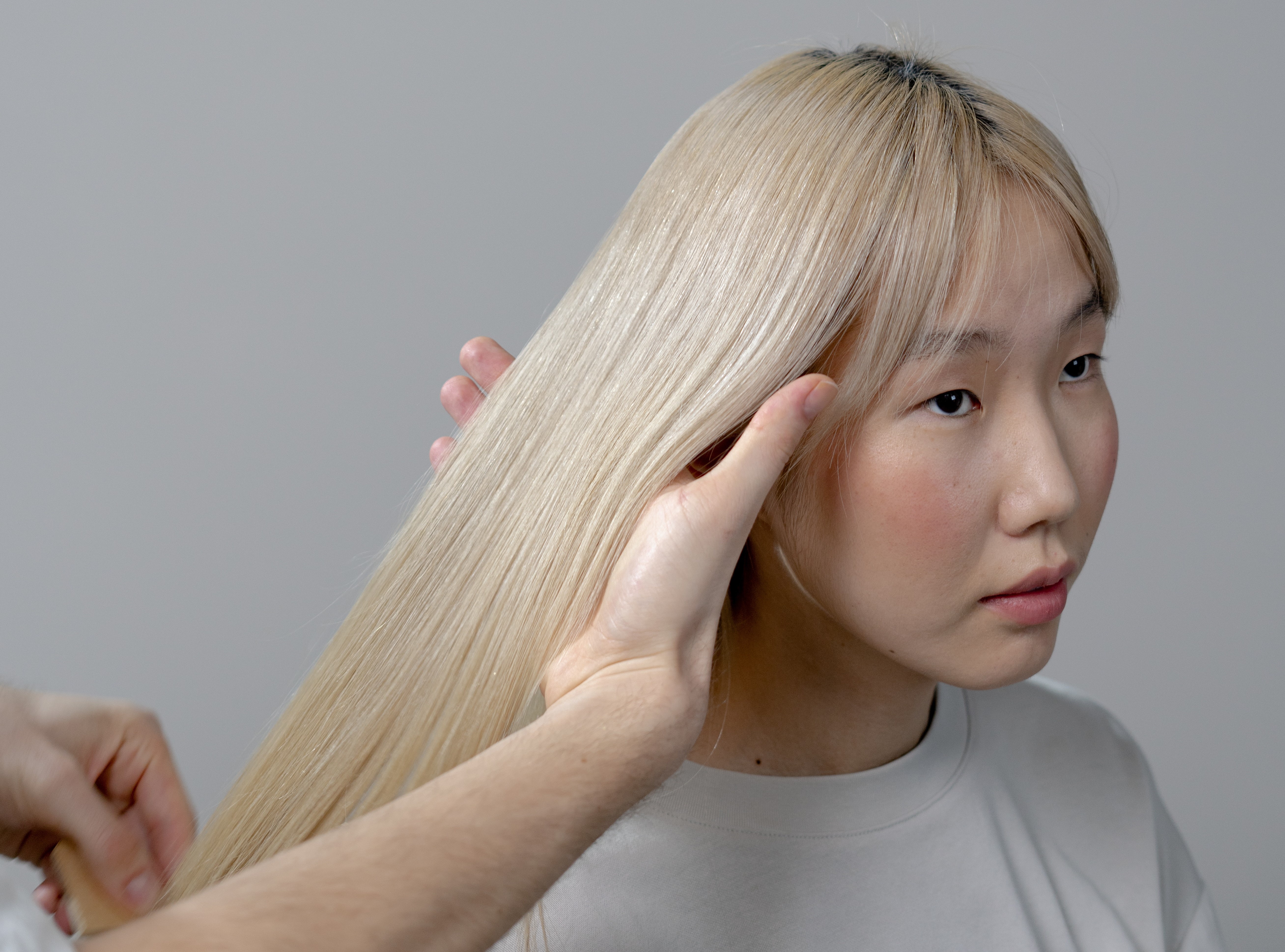 Tat ca ve phuong phap tiem vi diem de tri rung toc hinh anh