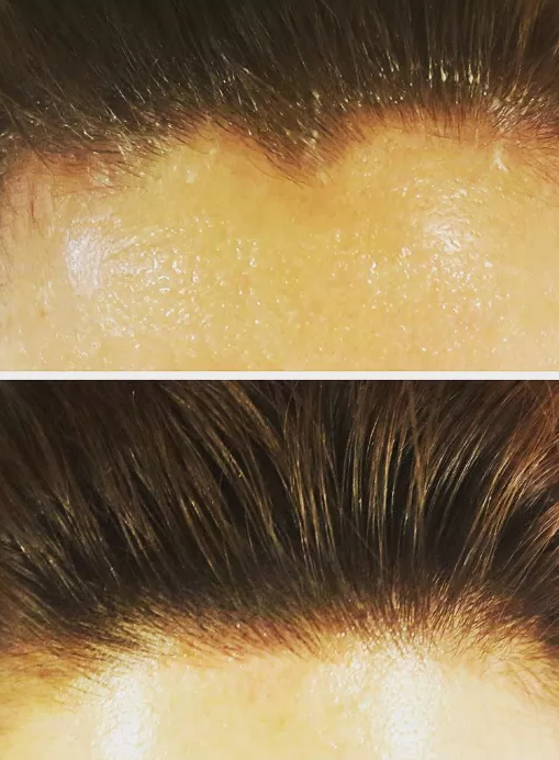 dieu khac chan toc anh 9