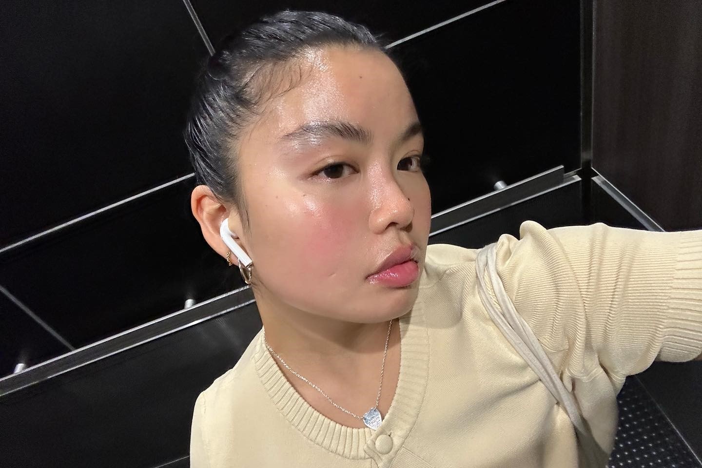 Nguoi tre Anh dua nhau tiem botox, filler hinh anh