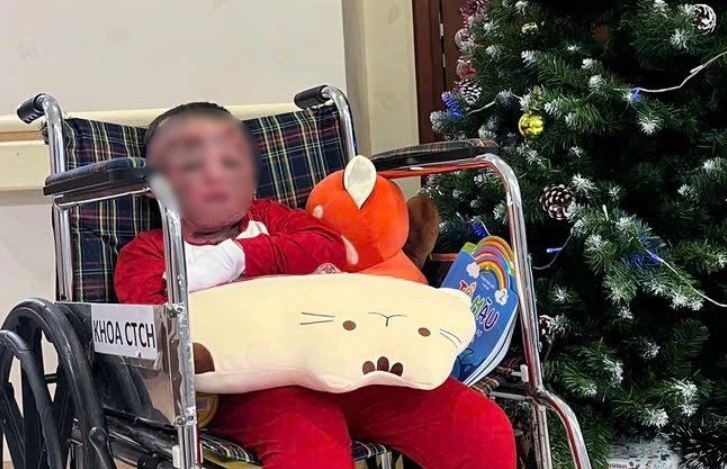 Be trai 5 tuoi bi cha dot xang bong 80% hinh anh