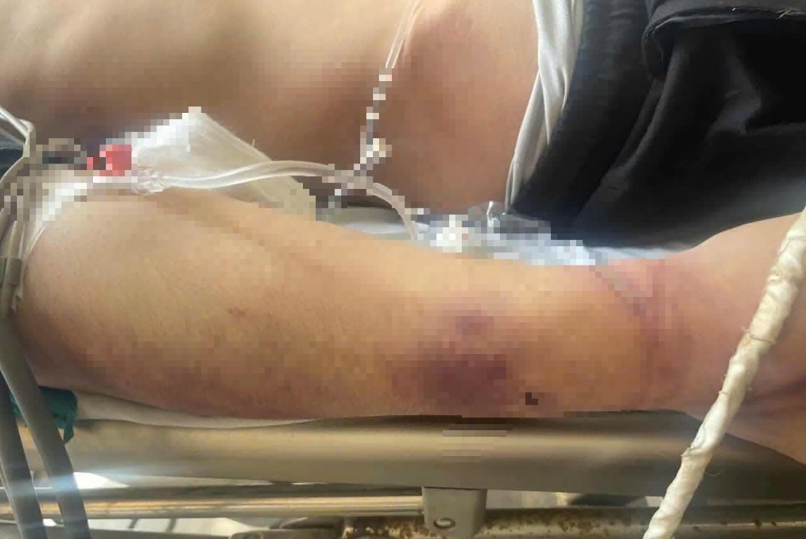 Loi ke nhan chung vu hoc vien tu vong sau 2 ngay nhap hoc hinh anh