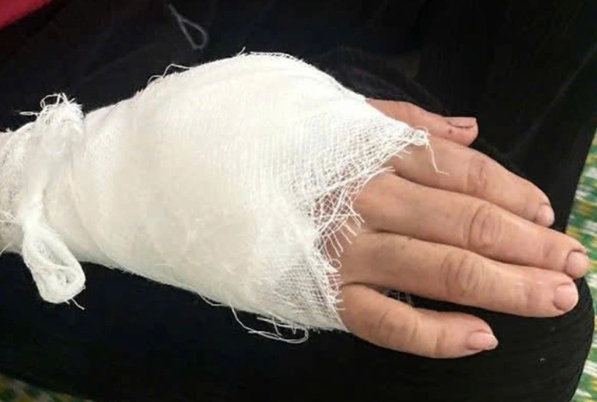 Khi hoang can nguoi anh 2