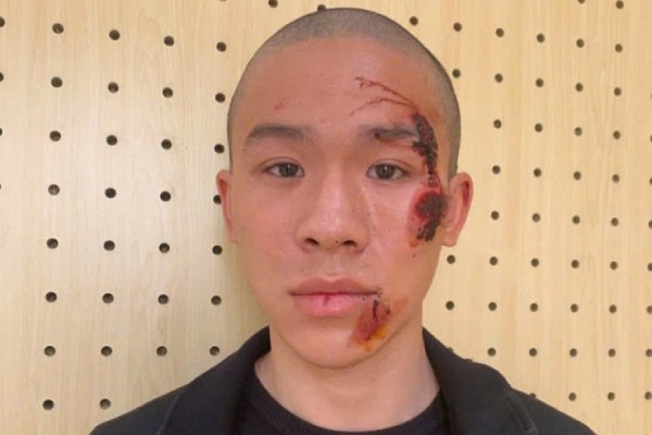 Khoi to, tam giam doi tuong 'thong chot' lao xe vao CSGT hinh anh