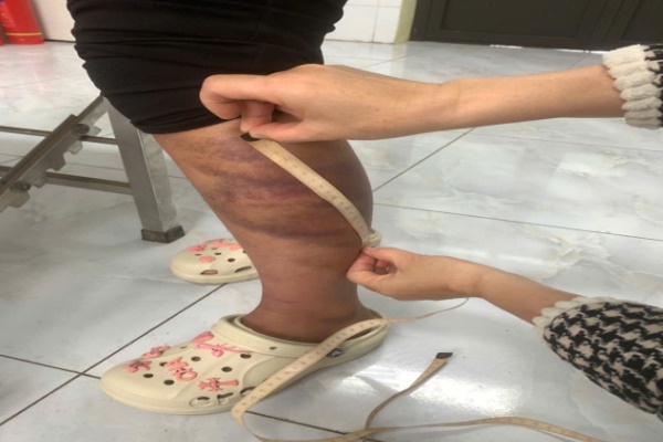 Tam giu,  nguoi dan ong,  nhieu lan,  bao hanh vo anh 1