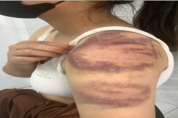 Tam giu nguoi dan ong nhieu lan bao hanh vo dang mang thai va con gai hinh anh