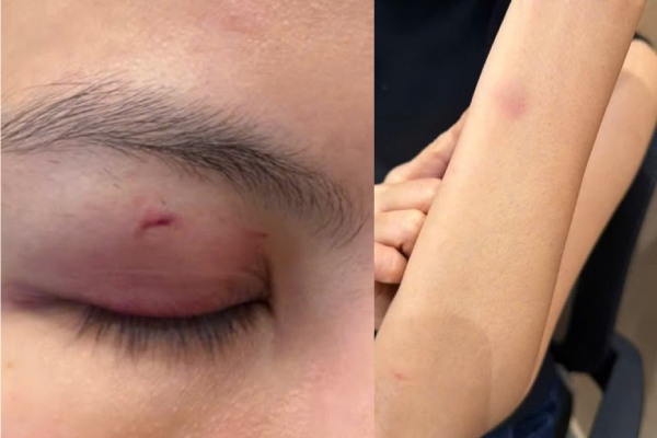 Cong an vao cuoc vu ca si Trung Quan Idol bi 'to' hanh hung nu bac si hinh anh