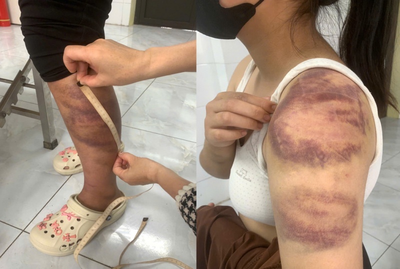 Khoi to doi tuong,  hanh ha vo con anh 2