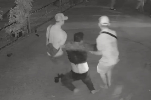 Hon chien giua dem khien mot nguoi nhap vien hinh anh