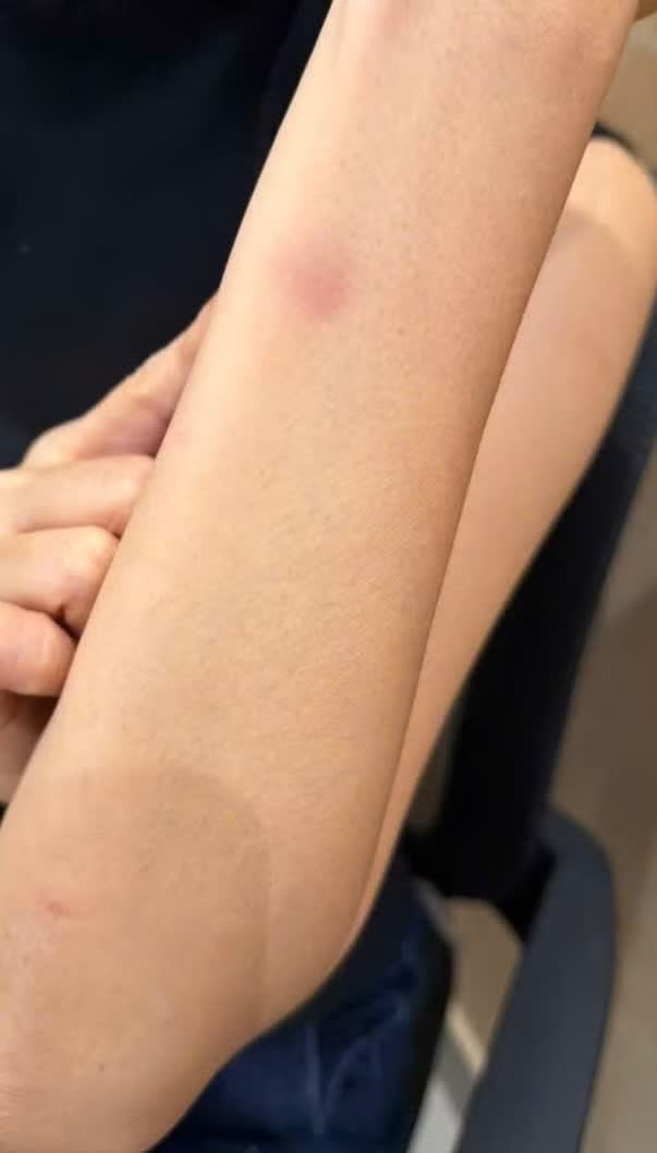 Trung Quan Idol,  hanh hung,  nu bac si anh 3