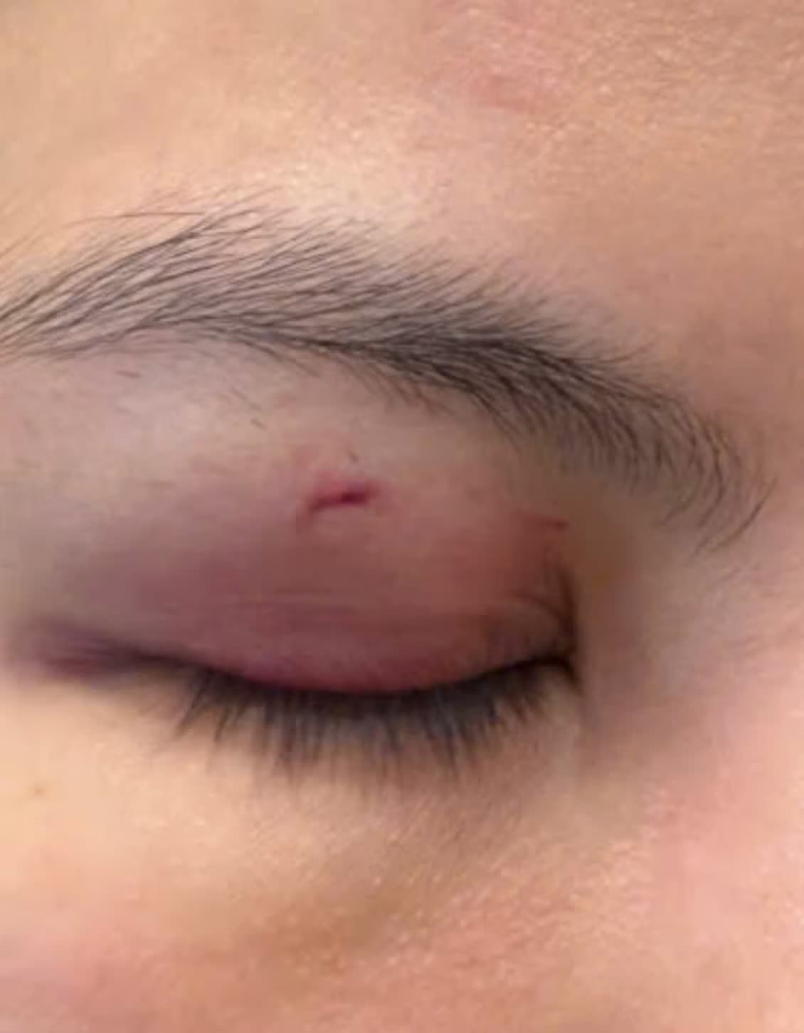 Trung Quan Idol,  hanh hung,  nu bac si anh 2