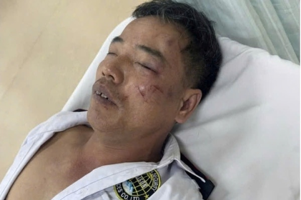 Truy tim nhom thanh nien net po, danh bao ve gay xuong suon hinh anh