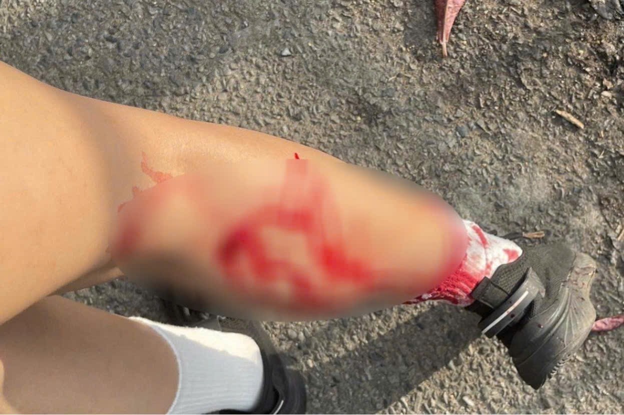 Khi hoang can nguoi o Vung Tau hinh anh