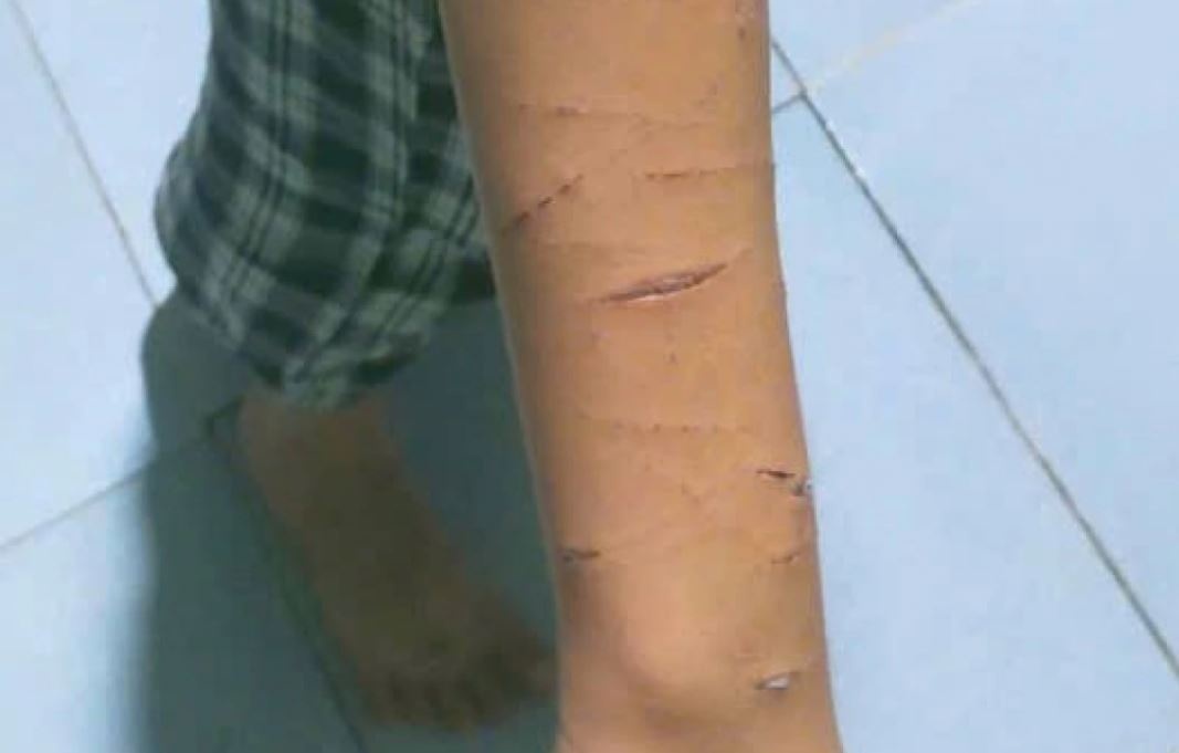 Chi ho lop 5 rach tay em bang dao roc giay hinh anh